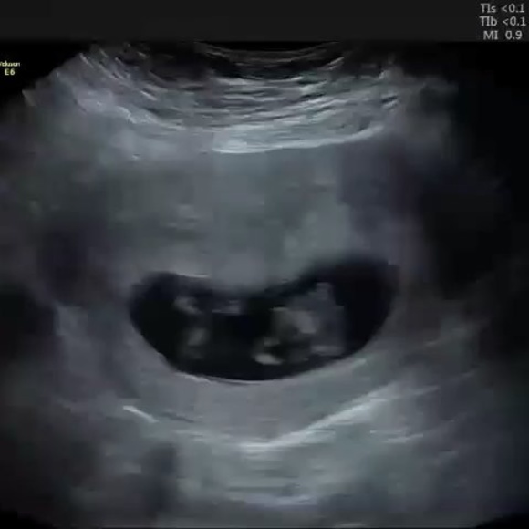 Meet your Posher, Chris - Picture 1 of 1